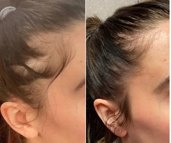 antes-x-depois-1