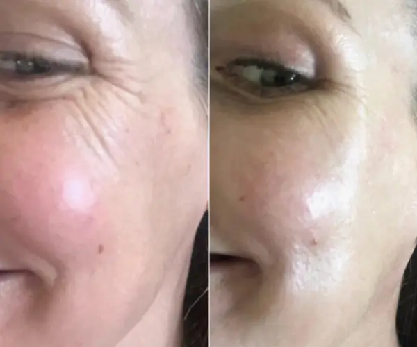 antes-x-depois-19