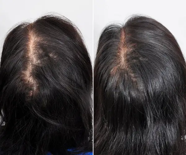 antes-x-depois-3