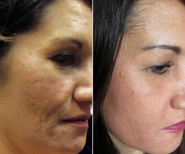 antes-x-depois-4