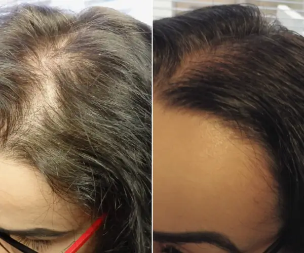 antes-x-depois-7
