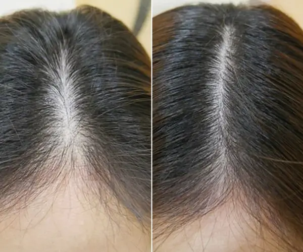 antes-x-depois-8