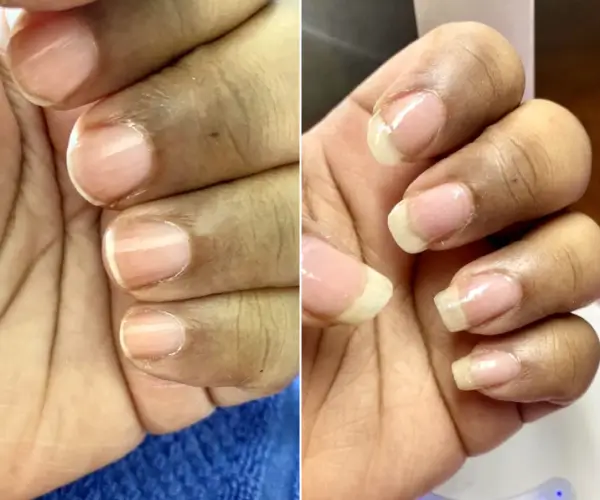 antes-x-depois-9